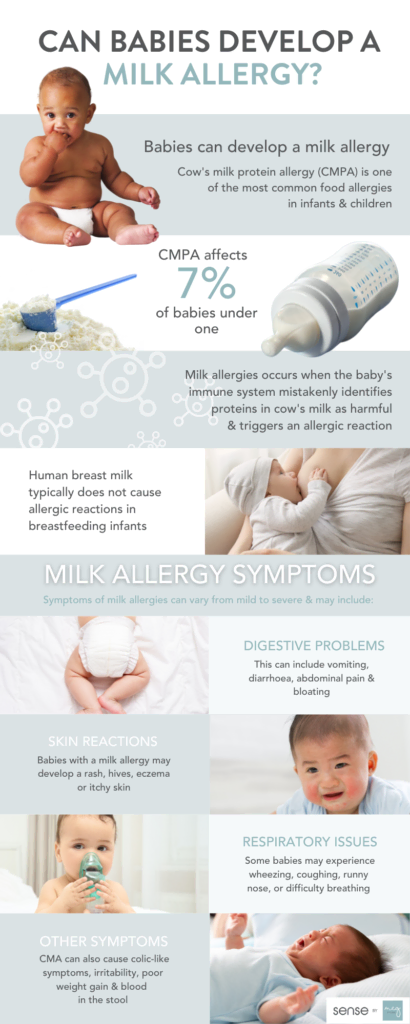 food allergy to milk symptoms